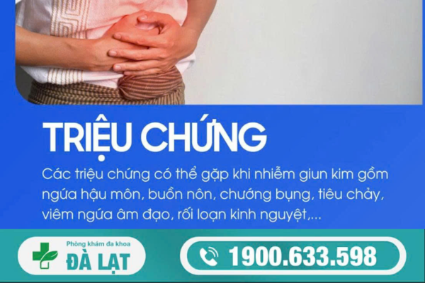 Hình ảnh minh họa